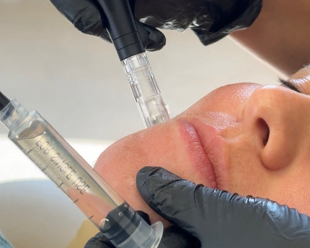 Salmon DNA Microneedling Face & Neck