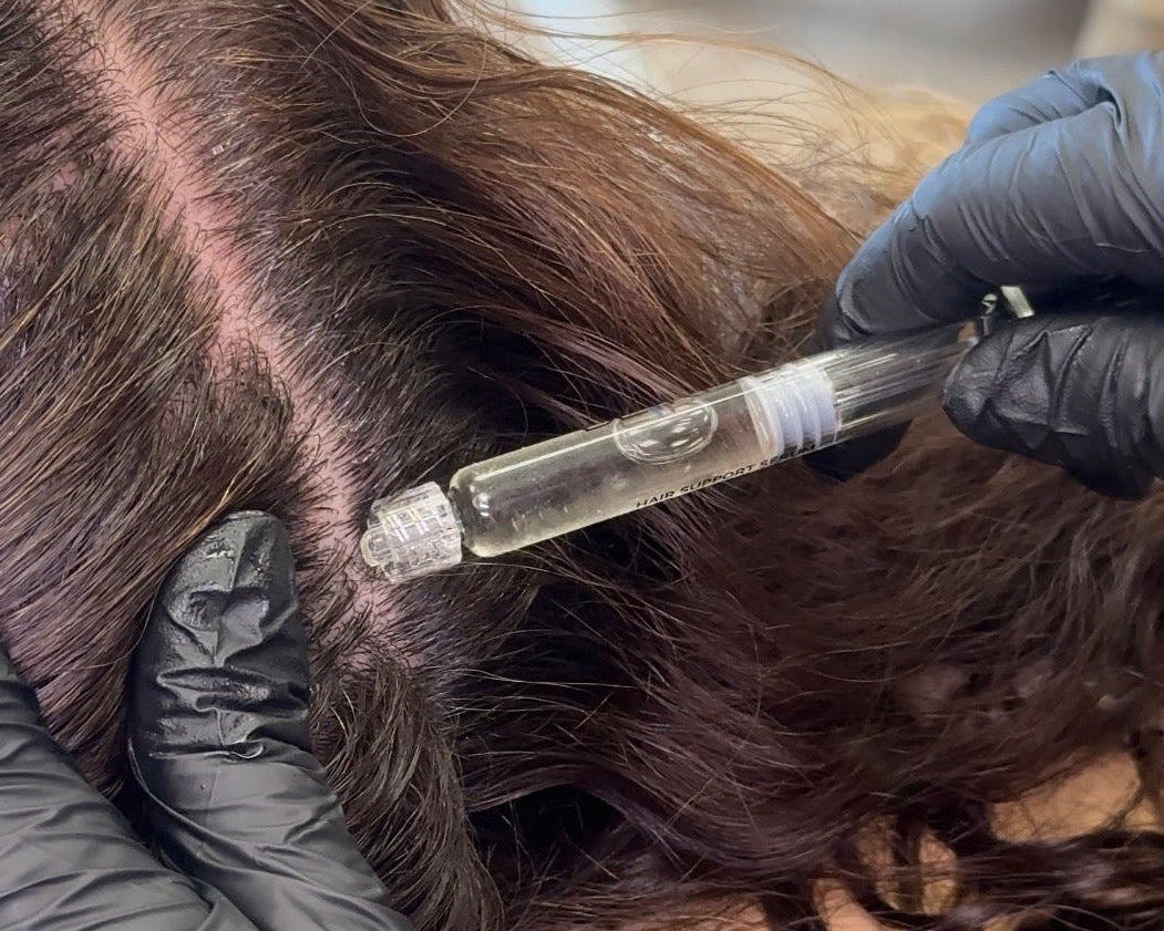 RBM Hair Restoration with Exosomes + Daily Exosomes Hair Support Serum